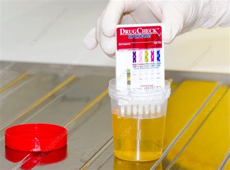 can clear eye eye drops alter a urine drug test|drug abuse in urine.